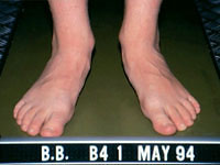 joint mobility treatments joint mobility treatments