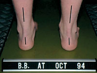 b4_1-3 After Treatment